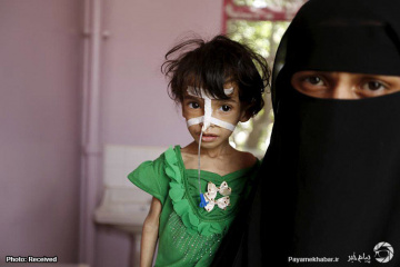 سوءتغذیه در کودکان یمنی